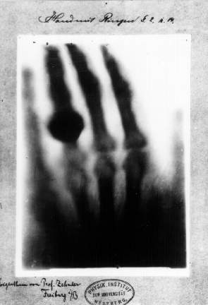 first x-ray photograph