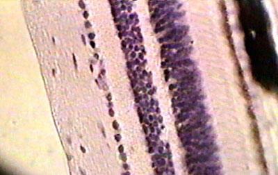 detail of retina