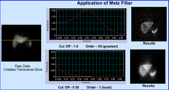 Metz filter and the extremes!