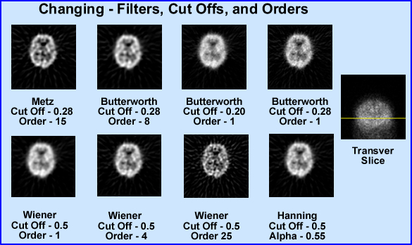 Brain scan with different fliter settings