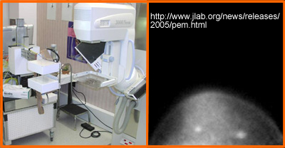 Positron Emission Mammography (PEM)