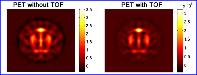 Another Example of PET with and without TOF