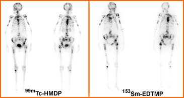 Compare HMDP to EDTMP