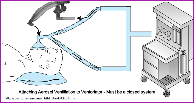 Radio-aerosol administratoin with pateint on a ventilator