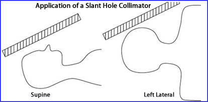 How does a slant hole collimator improve resolution
