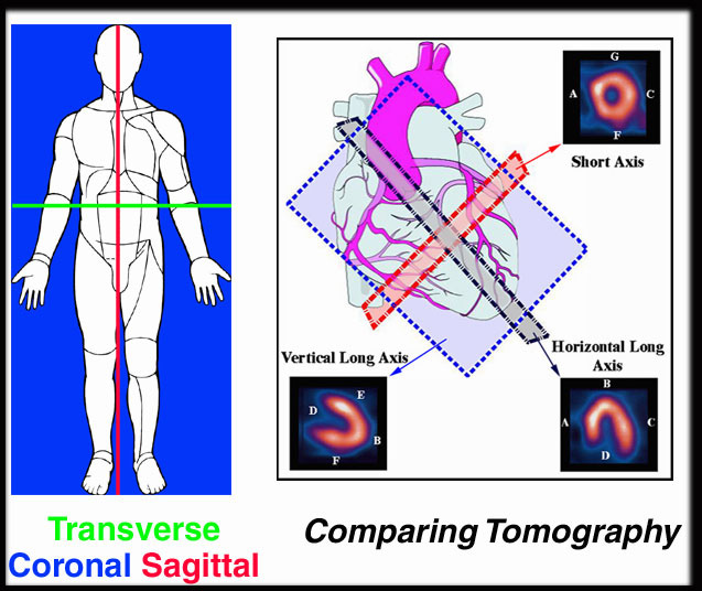 Comparing different tomographic displays