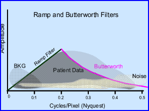 Results of Ramp and Butterworth Filters
