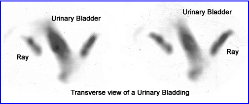 Movement via bladder filling and excessively hot bladder causing rays