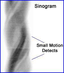 Sinogram with Small Motion defects